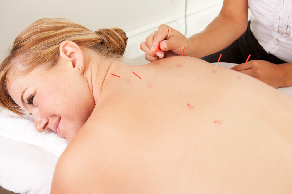 acupuncture Eastern Suburbs Melbourne